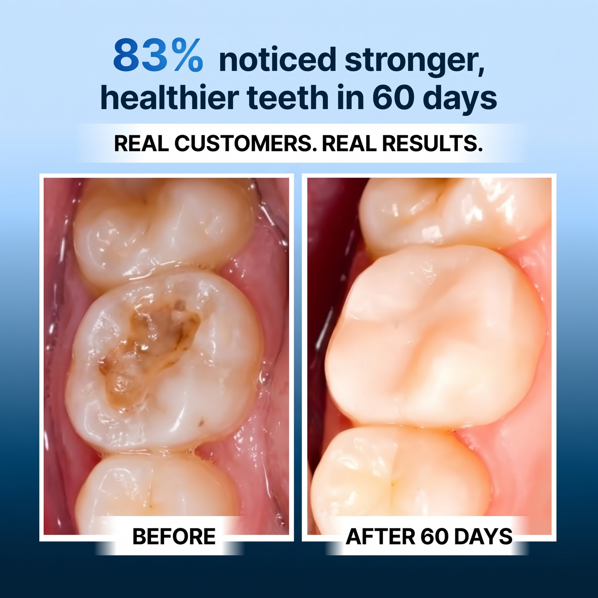 Oxyteeth Tooth Remineralization Drops