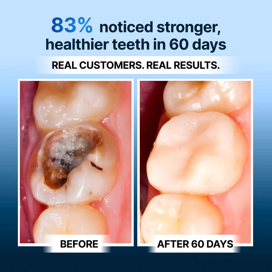 OxyTeeth Tooth Armor