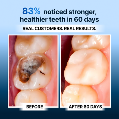 OxyTeeth Tooth Armor