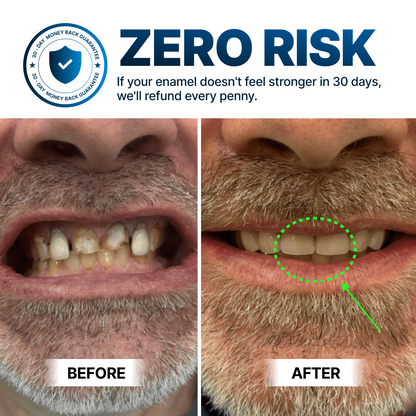 OxyTeeth Tooth Armor